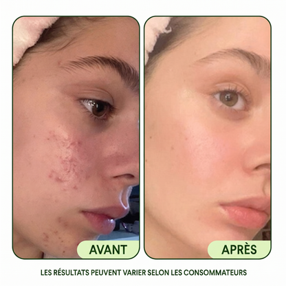 Pads Toner Renouvellement K8 — Jiyu by Omaya