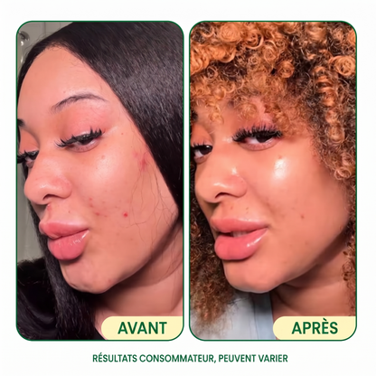Bundle Glow-Up Complet — Jiyu by Omaya